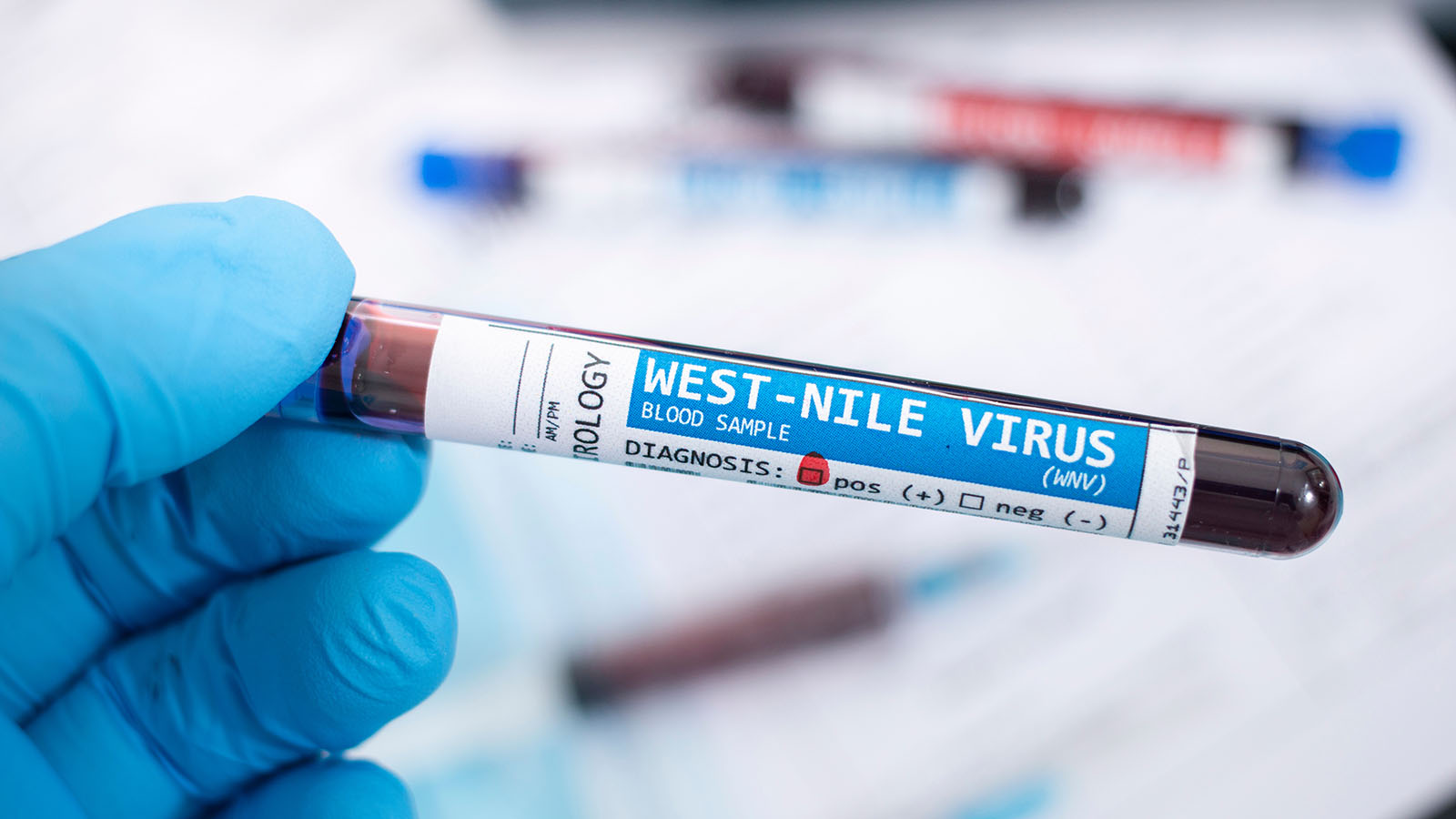 Blood sample labeled West Nile Virus